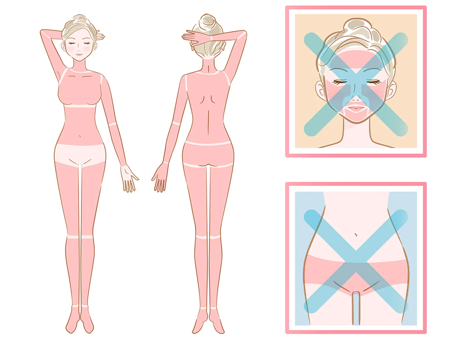 静岡市の医療脱毛で全身（VIO・フェイスなし）+ 臀部