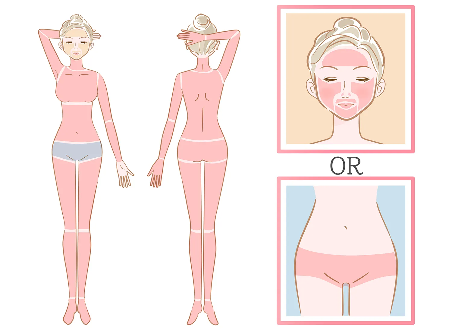 静岡市の医療脱毛で全身+VIOまたは顔　※男性は全身 +（VIOまたはヒゲ6部位）