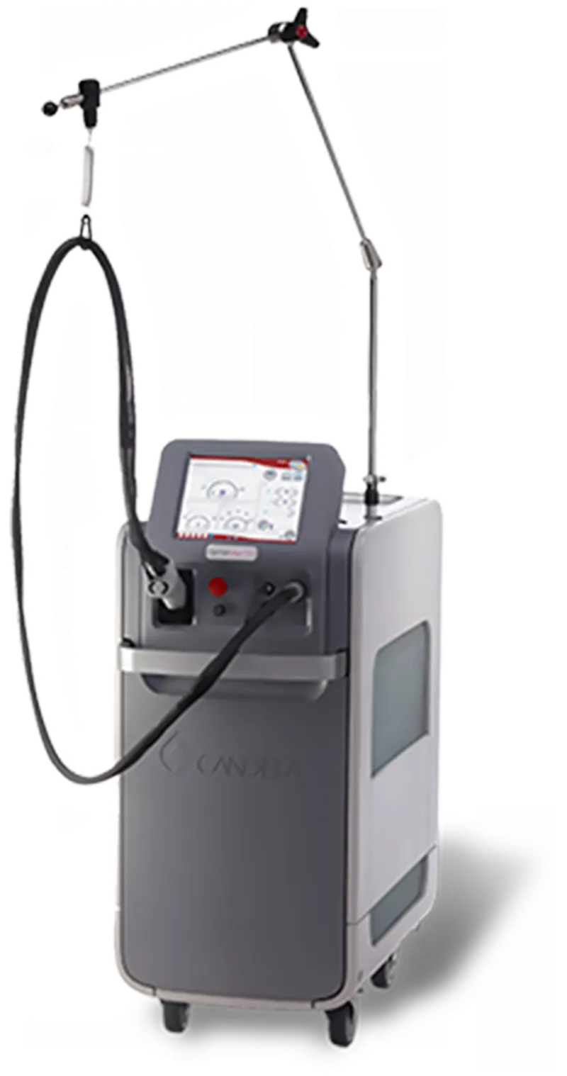静岡市の医療脱毛で使用される最新レーザー機器